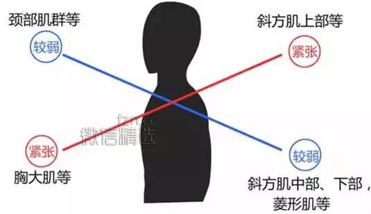 低头族（驼背、探颈），拿什么拯救你?